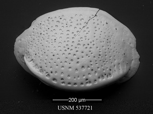 Pelecocythere sp.