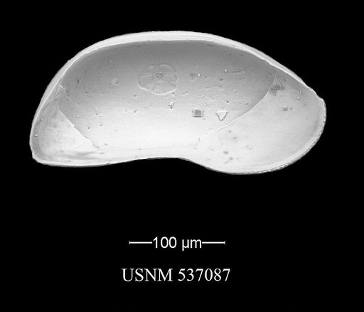 Argilloecia caju Yasuhara et al., 2009