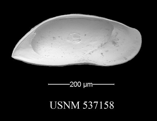 Argilloecia abba Yasuhara et al., 2009