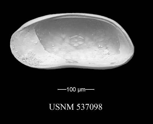 Argilloecia robinwhatleyi Yasuhara et al., 2009