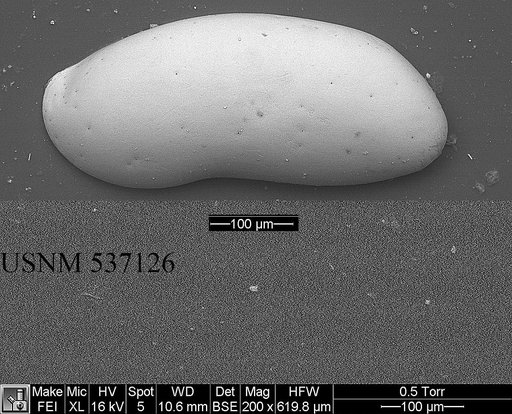 Argilloecia robinwhatleyi Yasuhara et al., 2009