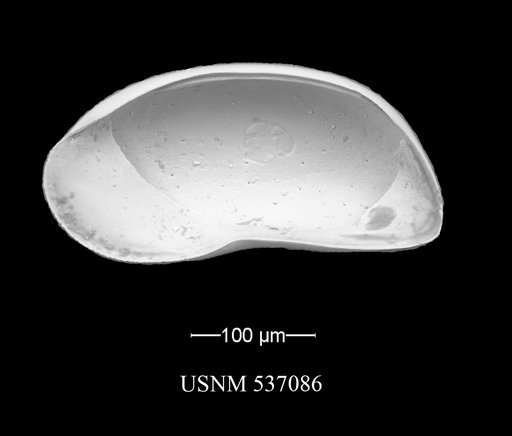 Argilloecia caju Yasuhara et al., 2009