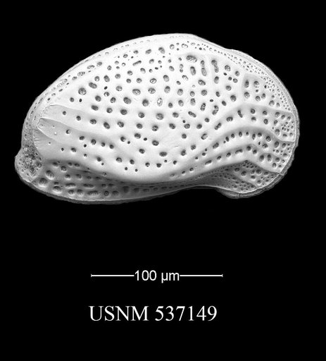 Posacythere hunti Yasuhara et al., 2009