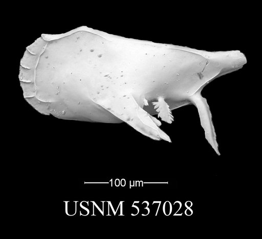 Pedicythere atroposopetasi Yasuhara et al., 2009