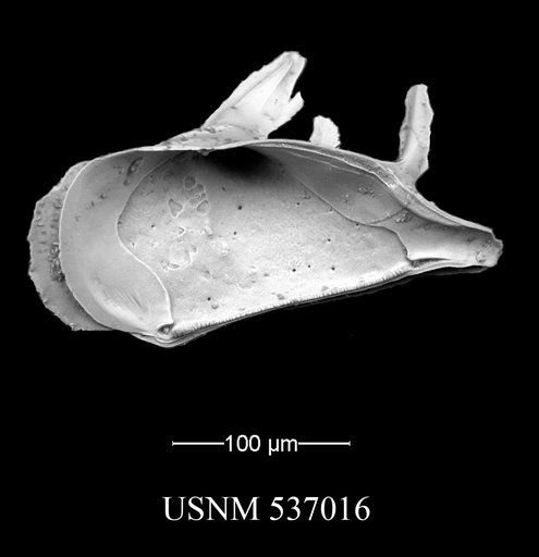 Pedicythere atroposopetasi Yasuhara et al., 2009