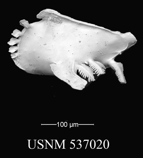 Pedicythere klothopetasi Yasuhara et al., 2009