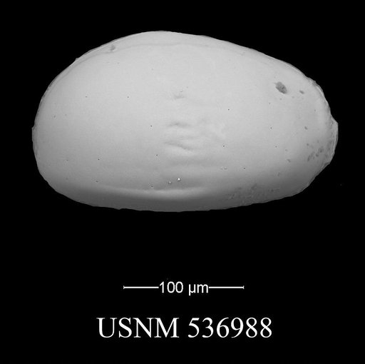 Xestoleberis oppoae Yasuhara et al., 2009