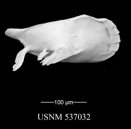 Pedicythere atroposopetasi Yasuhara et al., 2009