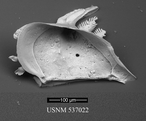Pedicythere klothopetasi Yasuhara et al., 2009