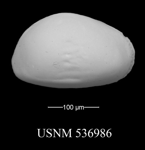 Xestoleberis oppoae Yasuhara et al., 2009