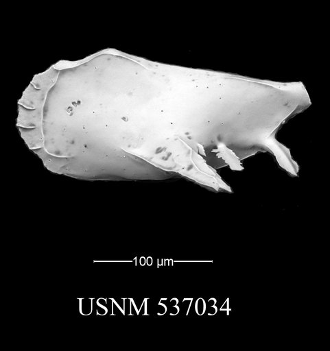 Pedicythere atroposopetasi Yasuhara et al., 2009