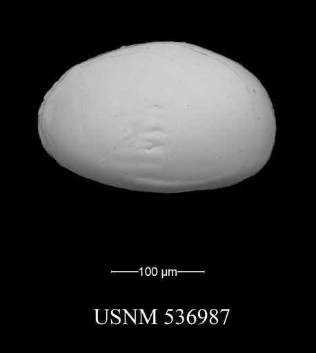 Xestoleberis oppoae Yasuhara et al., 2009