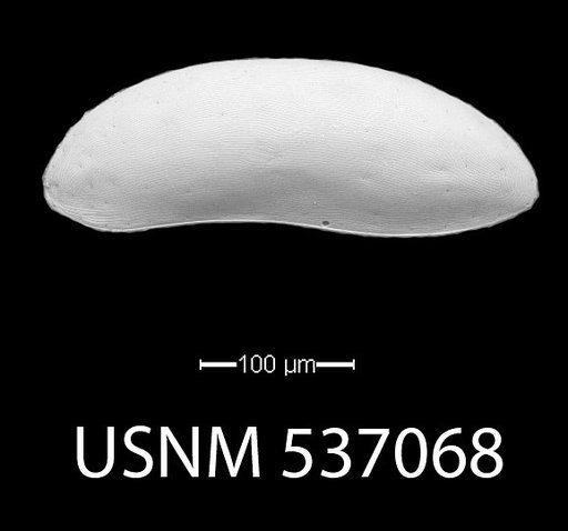 Paracytherois bondi Yasuhara et al., 2009