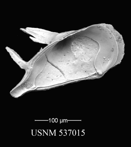 Pedicythere atroposopetasi Yasuhara et al., 2009