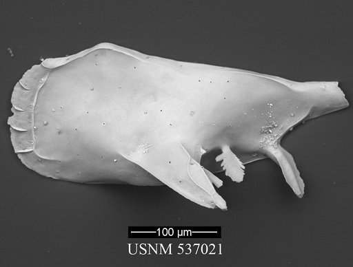 Pedicythere atroposopetasi Yasuhara et al., 2009