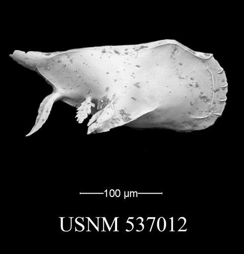 Pedicythere atroposopetasi Yasuhara et al., 2009