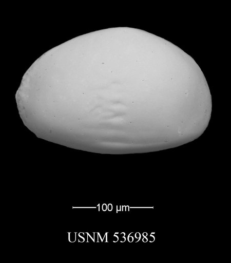 Xestoleberis oppoae Yasuhara et al., 2009