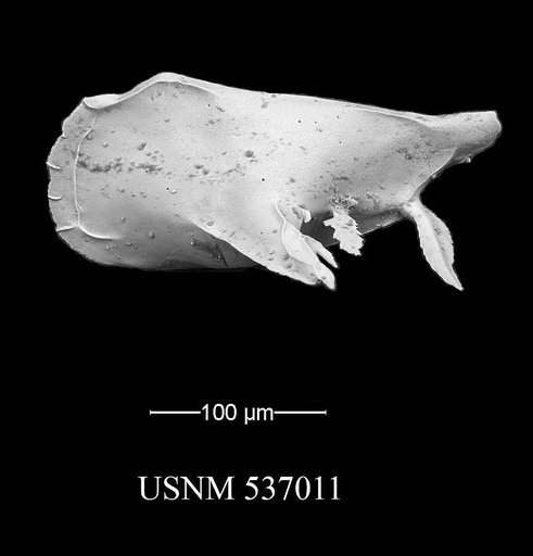 Pedicythere atroposopetasi Yasuhara et al., 2009