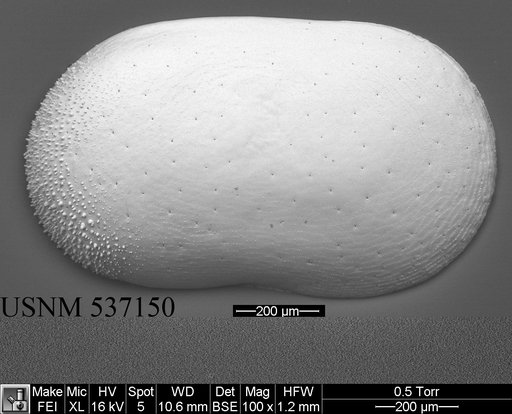 Cytherella robusta s.l. Colalongo & Pasini, 1980