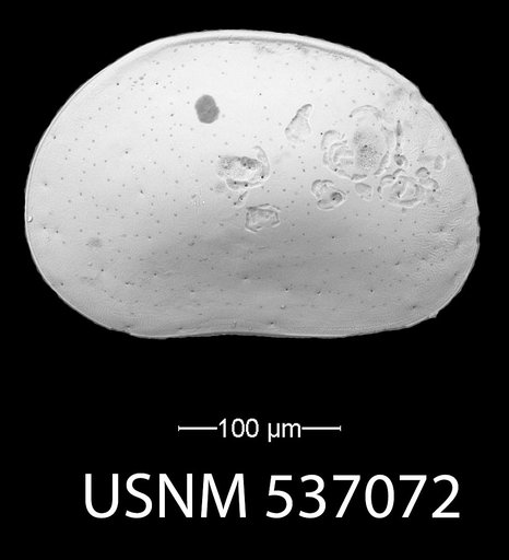 Chejudocythere tenuis Yasuhara et al., 2009
