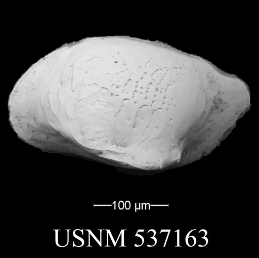Cytheropteron sp. s