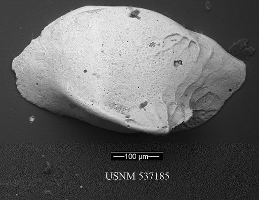 Cytheropteron sp. q