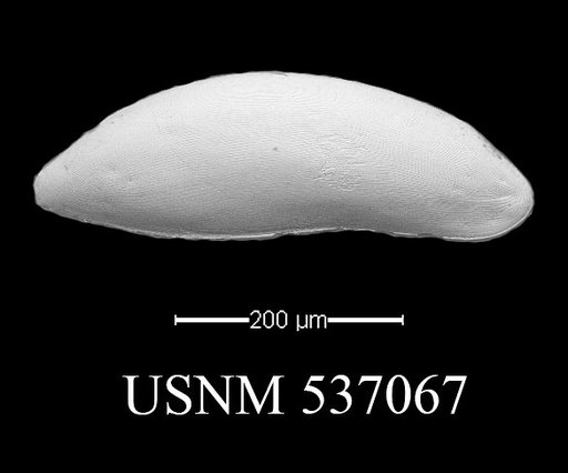 Paracytherois sp.