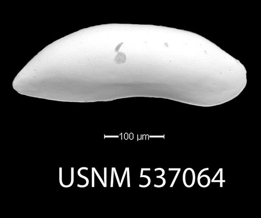 Paracytherois productum (Brady & Norman, 1889)