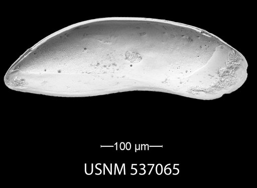 Paracytherois productum (Brady & Norman, 1889)
