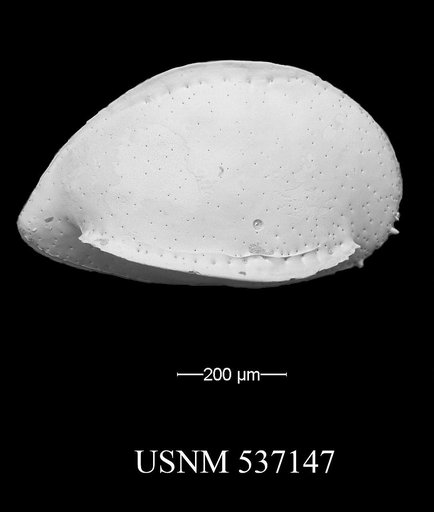 Pseudobosquetina sp.