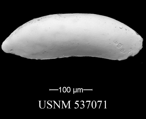 Paracytherois productum? (Brady & Norman, 1889)