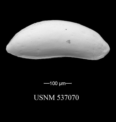 Paracytherois cf. bondi Yasuhara et al., 2009