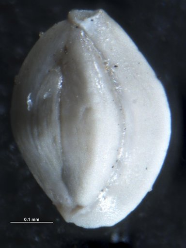 Quinqueloculina cf. lamarckiana d'Orbigny, 1839