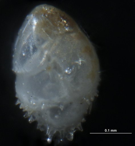 Bulimina aculeata d'Orbigny, 1826