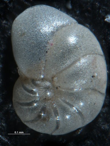 Hanzawaia concentrica (Cushman, 1918)