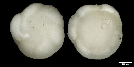 Oridorsalis umbonatus (Reuss, 1851)