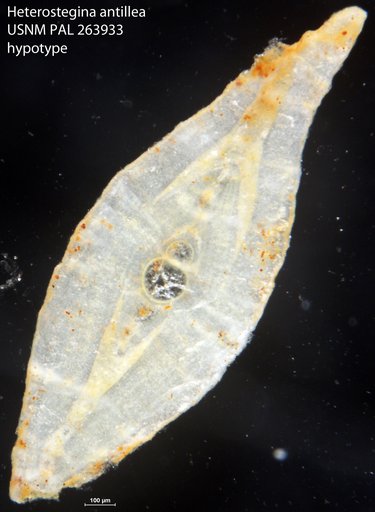 Heterostegina antillea Cushman, 1919
