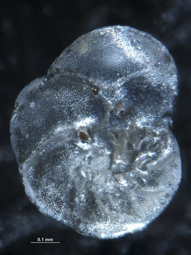 Hanzawaia concentrica f. typica (Cushman, 1918)