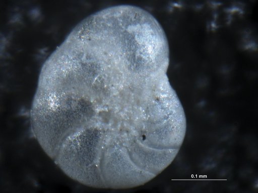 Haynesina germanica (Ehrenberg)