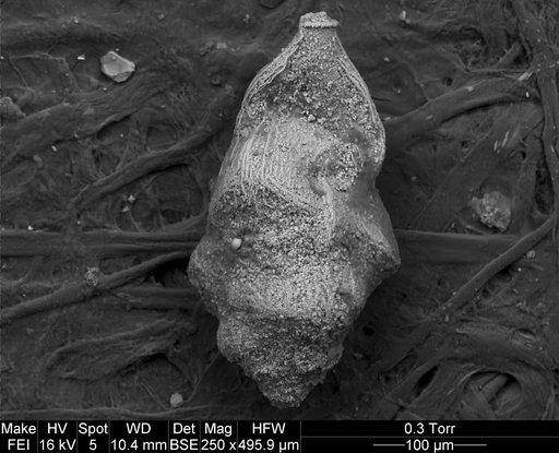 Angulogerina selseyensis (Heron-Allen & Earland, 1909)