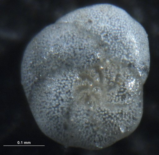 Rosalina floridana (Cushman, 1922)