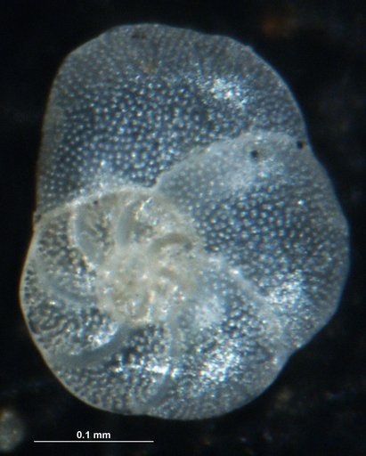 Rosalina floridana (Cushman, 1922)