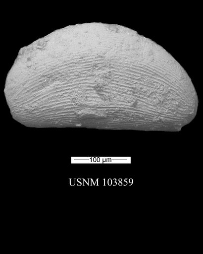 Darwinula dakotensis var. microstriatula Swain, 1946