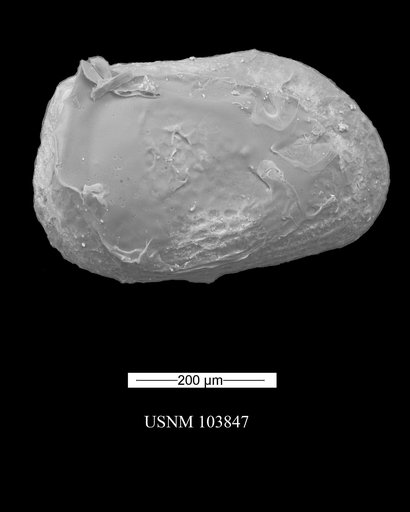 Metacypris postangularis Swain, 1946
