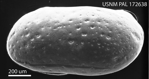 Pseudocytheretta burnsi (Ulrich & Bassler, 1904)