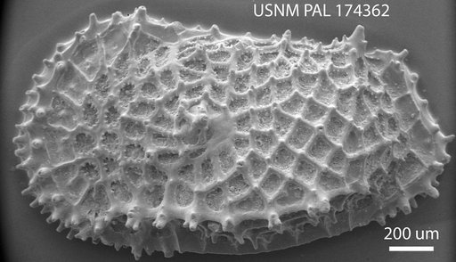 Agrenocythere radula (Brady, 1880)