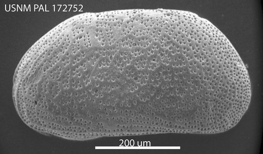 Microcytherura expanda Hazel in Ray, 1977
