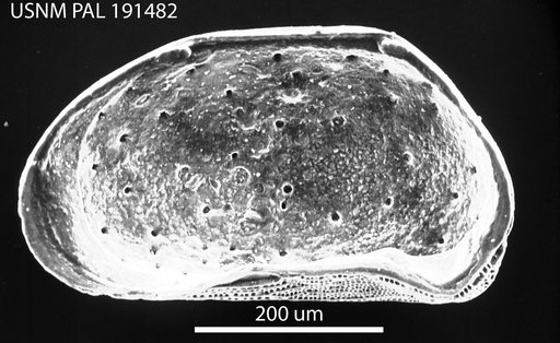 Microcytherura expanda Hazel in Ray, 1977