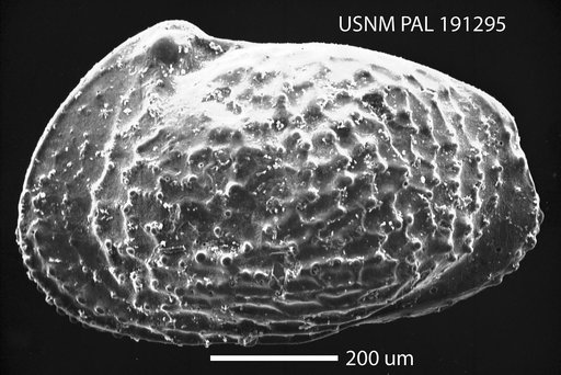 Echinocythereis mcquirti Howe