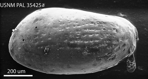 Pseudocytheretta burnsi (Ulrich & Bassler, 1904)
